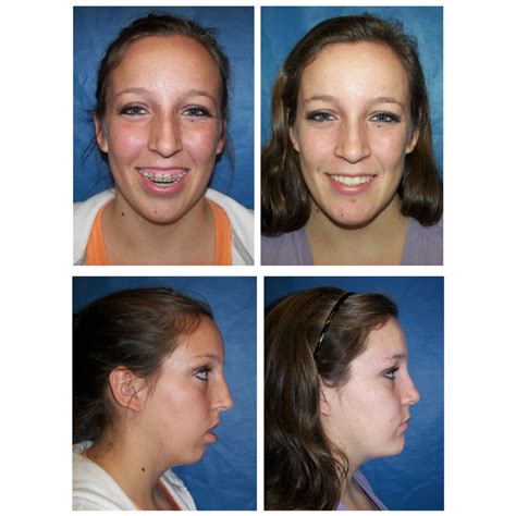 Treatment anxiety in oral and maxillofacial surgery. Results of a 